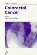Challenges in Colorectal Cancer