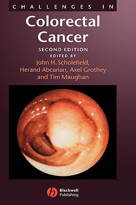 Challenges in Colorectal Cancer - Scholefield, John H (Editor), and Abcarian, Herand (Editor), and Maughan, Tim (Editor)