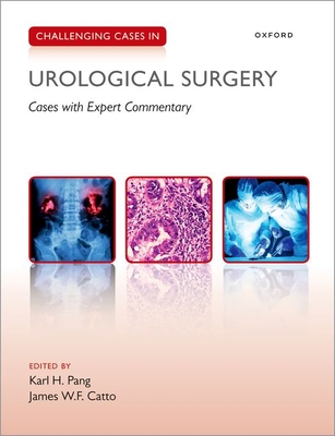 Challenging Cases in Urological Surgery - Pang, Karl (Volume editor), and Catto, James (Volume editor)