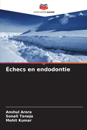 ?checs en endodontie