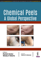 Chemical Peels: A Global Perspective