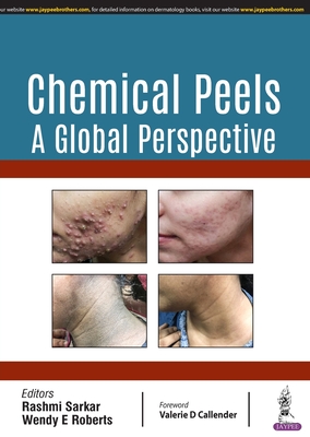 Chemical Peels: A Global Perspective - Sarkar, Rashmi, and Roberts, Wendy E, and Ghunawat, Sneha