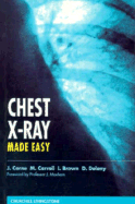 Chest X-Ray Made Easy