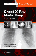 Chest X-Ray Made Easy