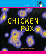 Chicken Pox