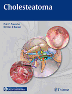 Cholesteatoma