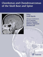 Chordomas and Chondrosarcomas of the Skull Base and Spine