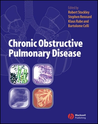 Chronic Obstructive Pulmonary Disease - Stockley, Robert A (Editor), and Rennard, Stephen I (Editor), and Rabe, Klaus (Editor)