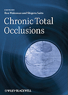 Chronic Total Occlusions: A Guide to Recanalization