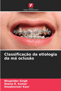 Classifica??o da etiologia da m� oclus?o