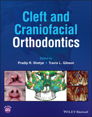 Cleft and Craniofacial Orthodontics - Shetye, Pradip R. (Editor), and Gibson, Travis L. (Editor)