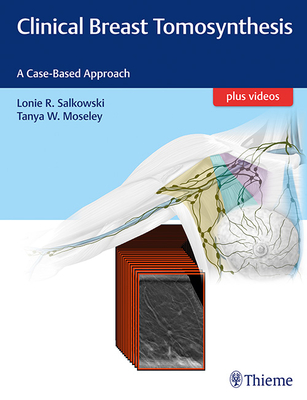Clinical Breast Tomosynthesis: A Case-Based Approach - Salkowski, Lonie R, MD, and Moseley, Tanya