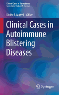 Clinical Cases in Autoimmune Blistering Diseases