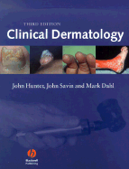 Clinical Dermatology
