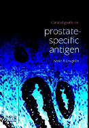 Clinical Guide to Prostate-Specific Antigen