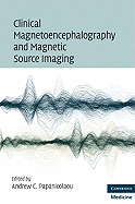 Clinical Magnetoencephalography and Magnetic Source Imaging