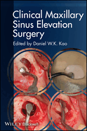 Clinical Maxillary Sinus Elevation Surgery