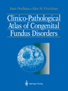 Clinico-Pathological Atlas of Congenital Fundus Disorders