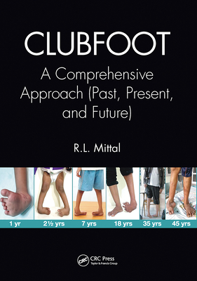Clubfoot: A Comprehensive Approach (Past, Present, and Future) - Mittal, R. L.