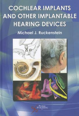 Cochlear Implants and Other Implantable Hearing Devices - Ruckenstein Michael Ed