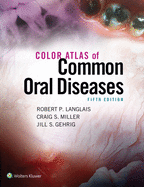 Color Atlas of Common Oral Diseases: .