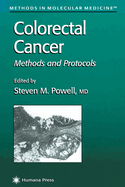Colorectal Cancer: Methods and Protocols