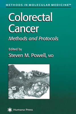 Colorectal Cancer: Methods and Protocols - Powell, Steven M. (Editor)