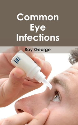 Common Eye Infections - George, Ray (Editor)