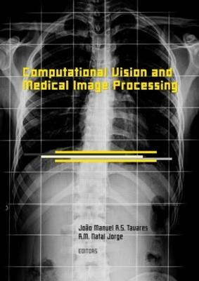 Computational Vision and Medical Image Processing: Vipimage 2007 - Tavares, Jo�o Manuel R S (Editor), and Jorge, R M Natal (Editor)