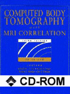 Computed Body Tomography with MRI Correlation