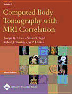 Computed Body Tomography with MRI Correlation