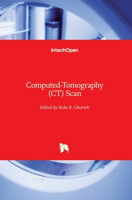 Computed-Tomography (CT) Scan - Gharieb, Reda R (Editor)