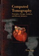 Computed Tomography: Principles, Design, Artifacts, and Recent Advances