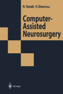 Computer-Assisted Neurosurgery - Tamaki, Norihiko (Editor), and Ehara, Kazumasa (Editor)