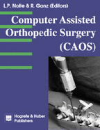 Computer Assisted Orthopedic Surgery (Caos)