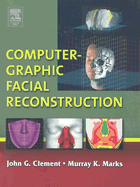 Computer-Graphic Facial Reconstruction
