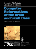 Computer Reformations of the Brain and Skull Base: Anatomy and Clinical Application
