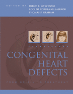 Congenital Heart Defects: From Origin to Treatment