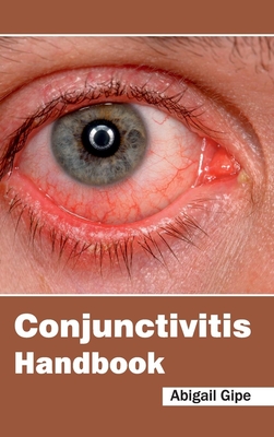 Conjunctivitis Handbook - Gipe, Abigail (Editor)
