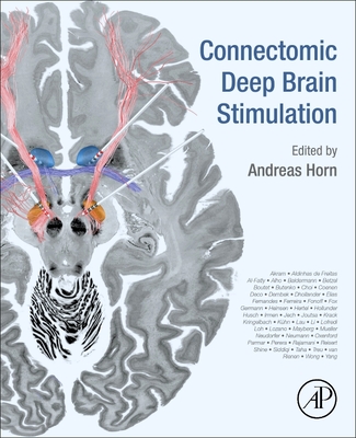 Connectomic Deep Brain Stimulation - Horn, Andreas (Editor)