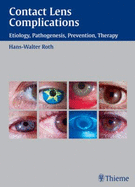 Contact Lens Complications - Roth, Hans-Walter
