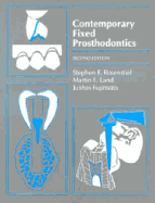 Contemporary Fixed Prosthodontics