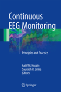 Continuous EEG Monitoring: Principles and Practice