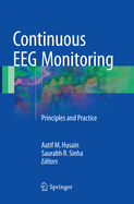Continuous EEG Monitoring: Principles and Practice