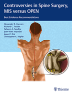 Controversies in Spine Surgery, MIS Versus Open: Best Evidence Recommendations