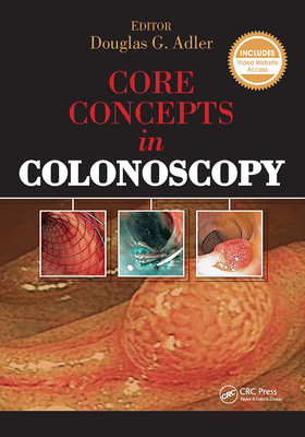Core Concepts in Colonoscopy - Adler, Douglas, MD