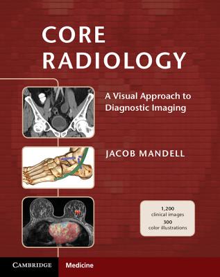 Core Radiology: A Visual Approach to Diagnostic Imaging - Mandell, Jacob