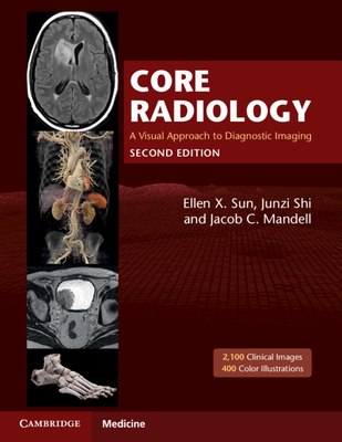 Core Radiology: A Visual Approach to Diagnostic Imaging - Sun, Ellen X (Editor), and Shi, Junzi (Editor), and Mandell, Jacob C (Editor)