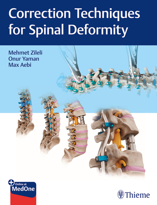 Correction Techniques for Spinal Deformity - Zileli, Mehmet (Editor), and Yaman, Onur (Editor), and Aebi, Max (Editor)