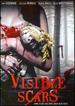 Visible Scars